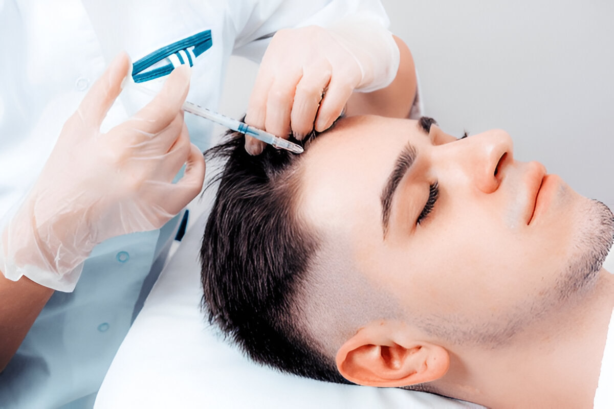 hair transplant London