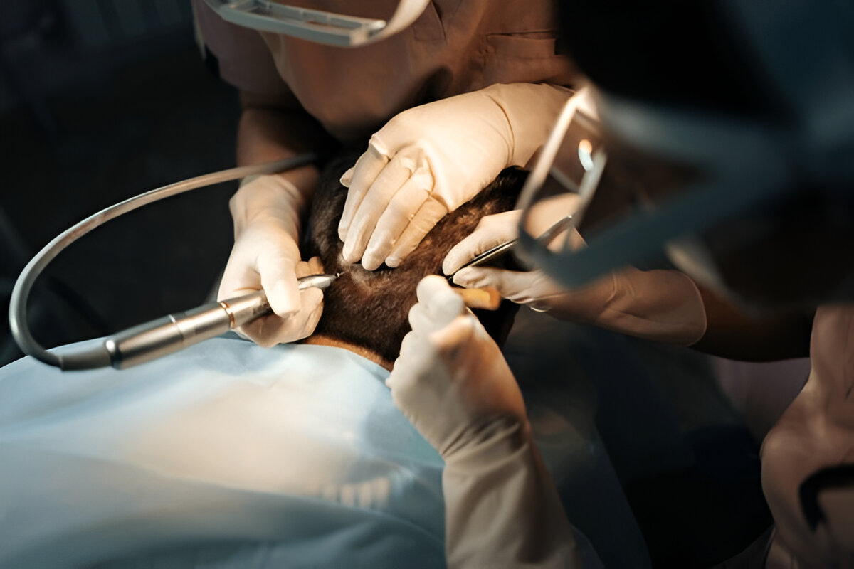 Hair Transplant
