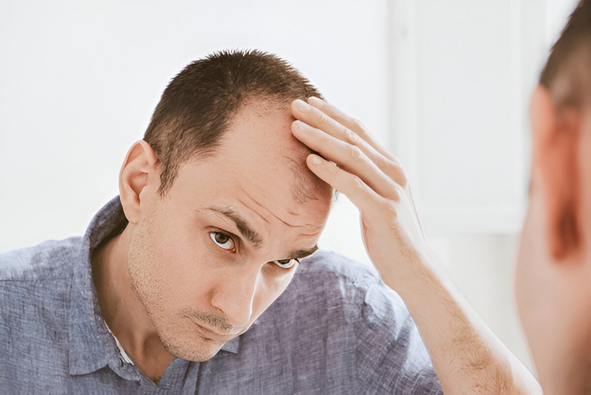 hair transplant cost