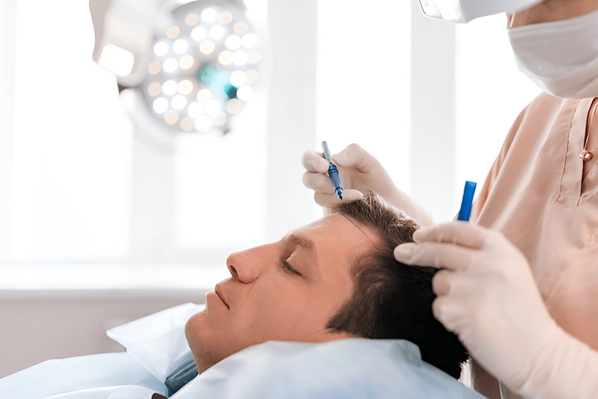 hair Transplant London